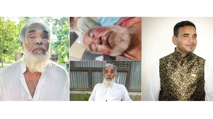 শটগানের গুলিতে দু’চোখ হারিয়ে নিঃস্ব জয় মিয়ার কান্না থামছে না